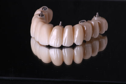 Implant Planning & Guided Surgery
