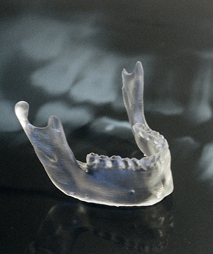 Implant Planning & Guided Surgery